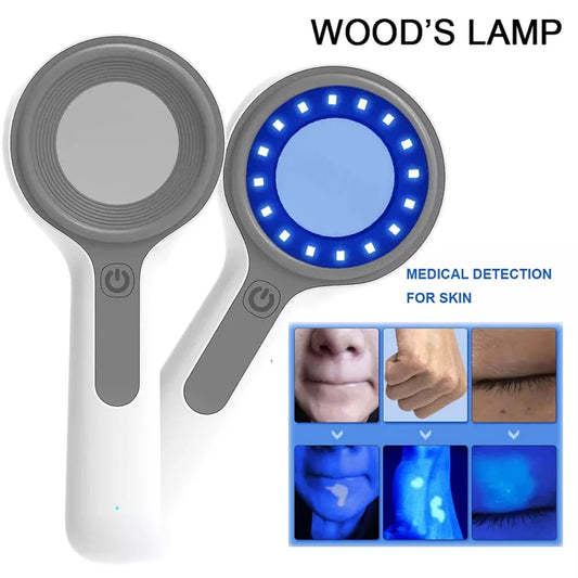 Woods Lamp Skin Analyzer, Fungus Detector